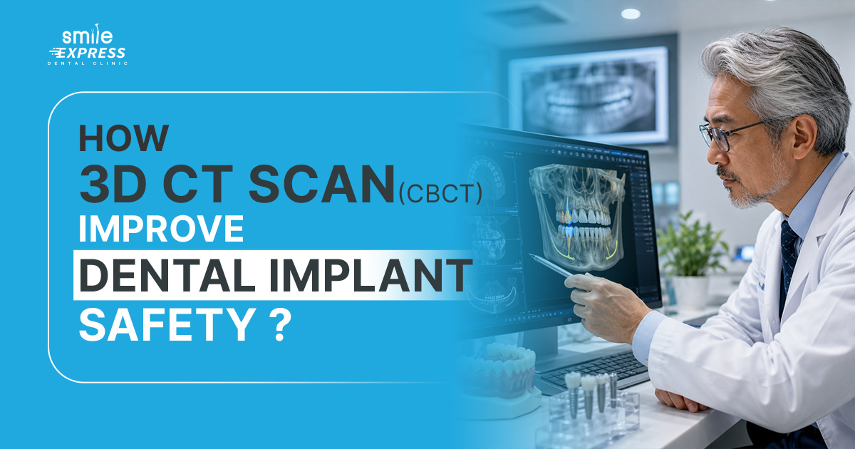 CBCT Improve Dental Implant