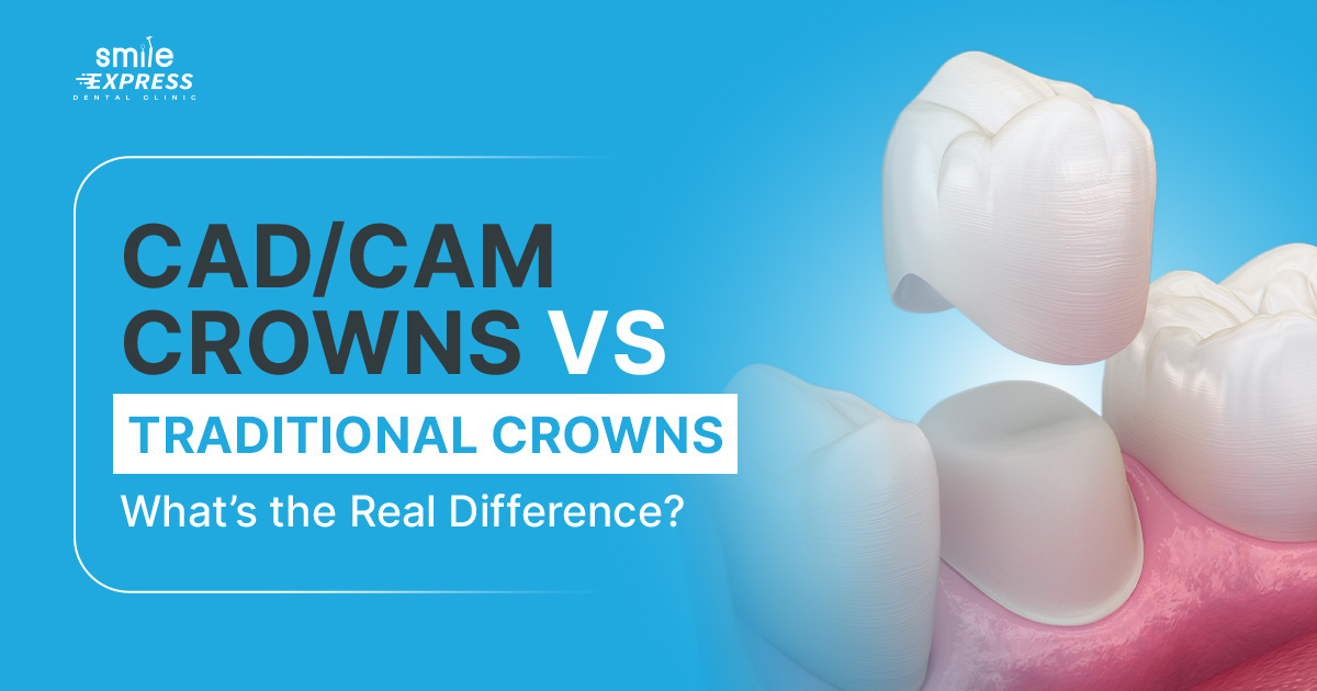 CAD/CAM Crowns vs Traditional Crowns