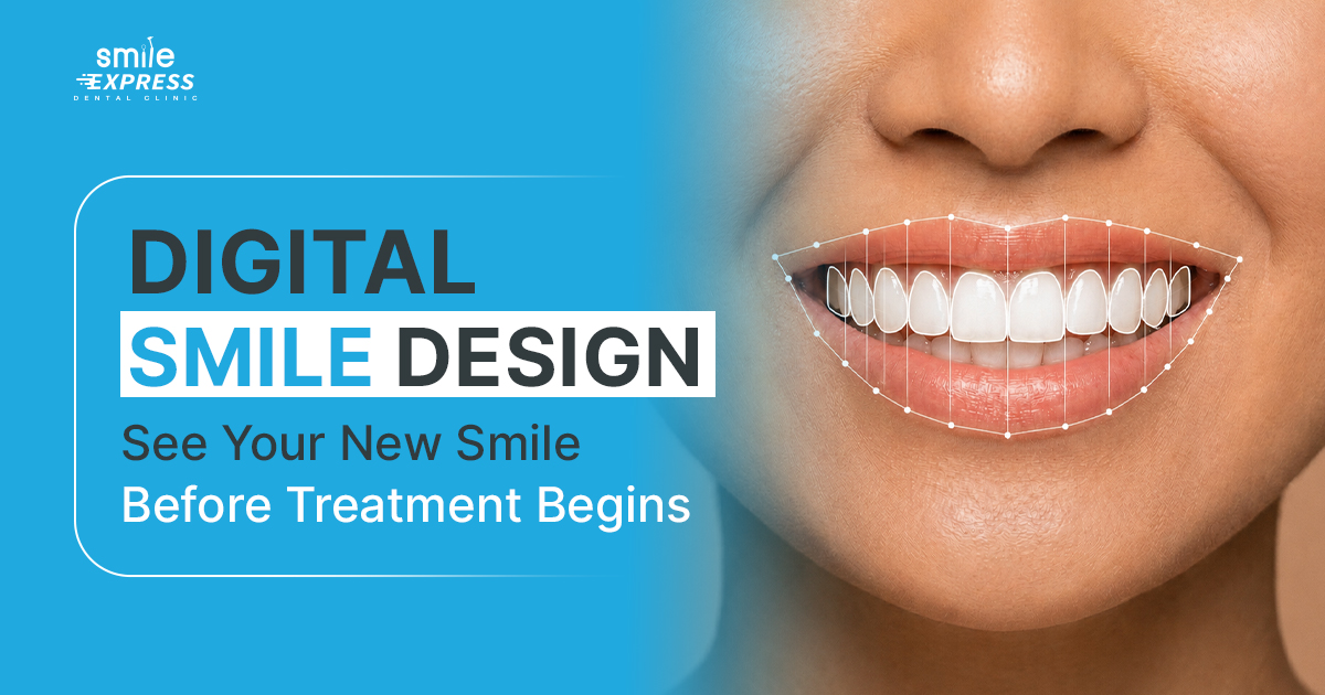 Digital Smile Design