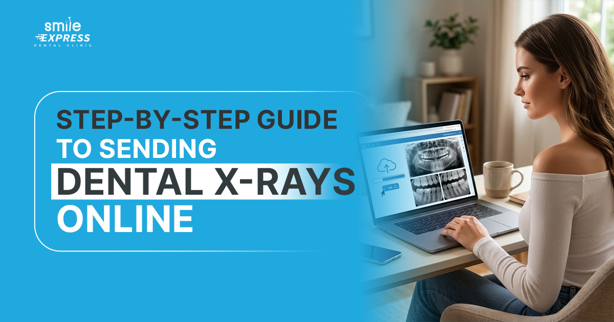 Send X-Rays for an Online Dental Evaluation